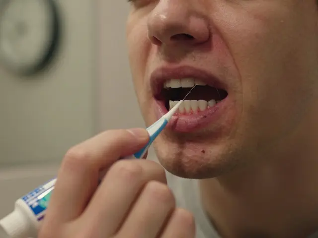 5 nejlepších způsobů, jak zabránit mezizubnímu kazu