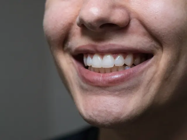 Nalepovací zuby: Jak dosáhnout nejlepšího efektu a vyhnout se běžným chybám