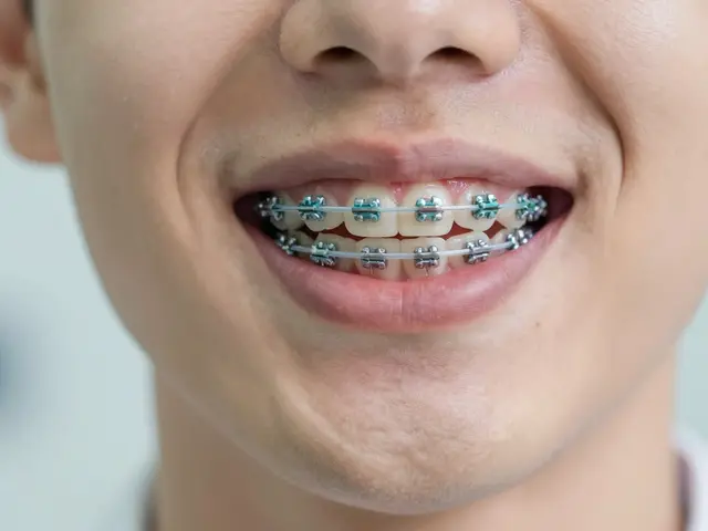 Gumičky na rovnátka: Jak je správně měnit a co dělat, když prasknou